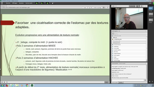 DU_PEC_Obésité_26042019_PILIERE_Les bases de la réalimentation après chirurgie bariatrique