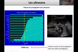 Bases biophysiques Echographie - 1ère partie - Dr SCHUSTER