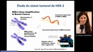 DU Lymphologie - E. CHARTRON