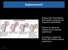 Fractures du sujet âgé
