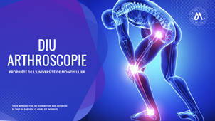 Hanche - Limites de l'arthroscopie de hanche (Limites - Dysplasie ou chirurgie conservatrice - Arthrose)