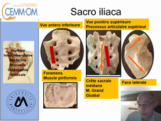 Théorie_MI_anatomie_sacroiliaque