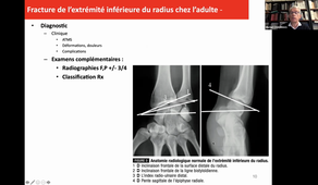 DFASM1 MIC BO 16/12/2020	17:00	18:00	BO		Best of orthopédie des membres supérieurs	Pr Michel Chammas	UPM 1