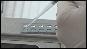 Travaux Pratiques Immunologie