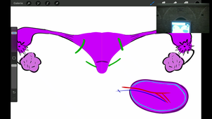 06/02/2023	09h00	11h00	Appareil rénal et voies urinaires - CM6	Dr Duraes	Amphi Anatomie	DFGSM2