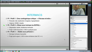 D.U Insuffisance Cardiaque Dr P GAUDARD