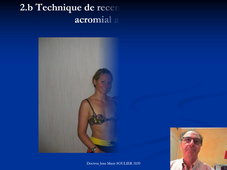 Epaule Dr. Soulier