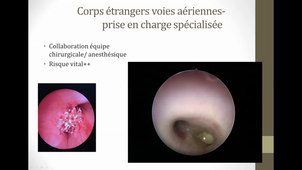 25/03/2021  Angines de l'adulte et de l'enfant et rhinopharyngites de l'enfant- otites infectieuses de l'adulte et de l'enfant Détresse respiratoire aigüe du nourisson, de l'enfant. Corps étrangers des voies a   