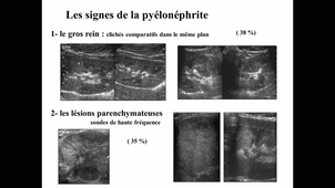 DFASM2 MIE D Morin 17/09/2020