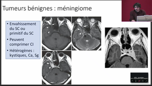 DFGSM2 UE : TÊTE ET COU - CM9 Radioanatomie de la tête et du cou - 03/04/2026