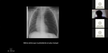 Indication de l'imagerie en pathologie pédiatrique