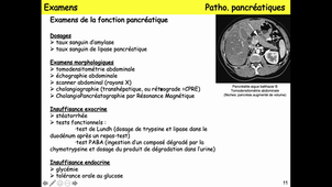 DUT Diet - Cours Physiopatho 27-01-2021