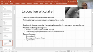 DFASM1 MIC 25/11/2020 Conduite à tenir devant une arthrite d'évolution récente Dr Claire Rempenault