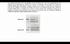 TD dégradation des ARNs et traduction HLBI504