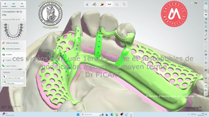 2024_MAND_K32_étape3.mp4