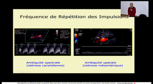 08 - Bases du doppler 2-2