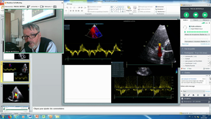 DU  Insuffisance Cardiaque Pr Battistella Cas clinique 29 Mars 2019