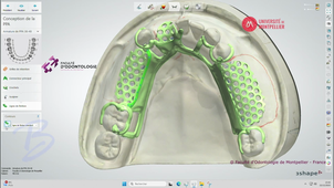 3SHAPE2025_PPAM MD 06 lignes de finition.mp4