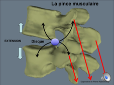 Dr. Bonneau - Rachis lombaire