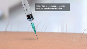Les neuroprostanes - Projet de recherche entre la chimie et la physiologie
