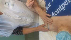 DU DLM Membres Supérieurs : Segmtaire bras
