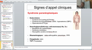 DFASM1 MIB 29/01/2021	16:00	18:00	Diagnostic des cancers : signes d'appel et investigations para-cliniques ; caractérisation du stade ; pronostic	PE. COLOMBO	salle 301