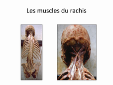 Rachis_Theorie_Cervical_Whiplash_Bonneau_2020