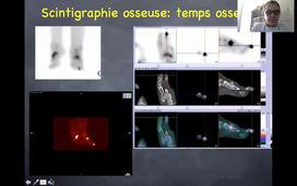 L. Collombier - Imagerie et pied infecté