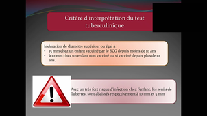 DFASM2 MIE Johan_MOREAU_Tuberculose_10092020