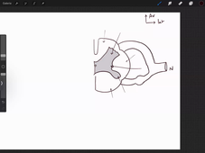 30-08-24-DFGSM2-Appareil neuro-M Bertrand CM1 et 2.mp4