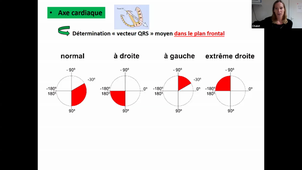04-12-2020-UE-cardio-vasculaire-Shuster Iris