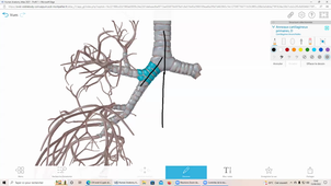 13/09/2022	13h30	15h30	Appareil respiratoire - CM 4.2 anatomie	Pr CAPTIER Guillaume	Amphi UPM	DFGSM3