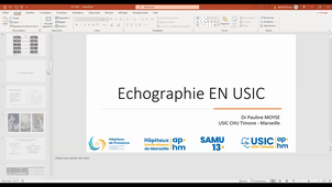 Echographie aux soins intensifs cardialogique.mp4
