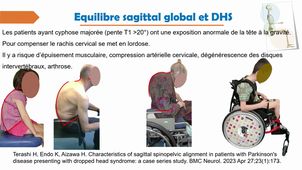 DIU positionnement T_te tombante F Nouvel 2025.mp4