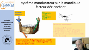 Dérangement Temporo Mandibulaire