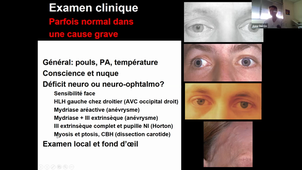 01/03/2023	13h30 	15h30	Neurologie - CM8	Pr Ducros	Classe virtuelle	DFGSM3