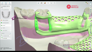 3SHAPE2025_PPAM MD 04 connecteurs secondaires.mp4