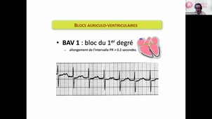 18/01/2021	14:00	17:00	DFGSM3 UE Cardiologie	PASQUIE JL	Salle 311