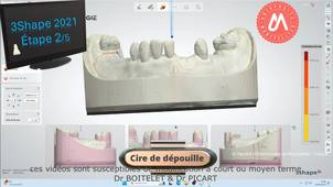 2025_MAND_K32_étape2_préparation.mp4