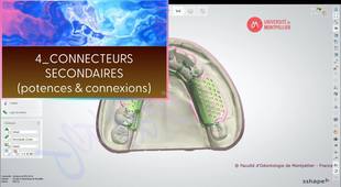 3SHAPE2025_PPAM MD 04 connecteurs secondaires.mp4