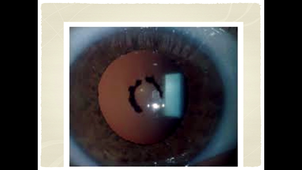 Dr Mamouni - Best Of - Ophtalmo