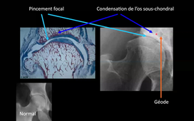 07/04/2021	15h00	18h00	Ateliers d'imagerie - imagerie digestive - imagerie ostéo-articulaire	BENOUDIFA Bachir - WANTZ William	Amphi UPM		DFASM3