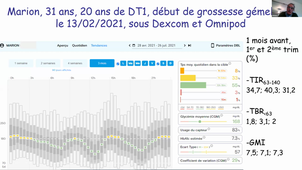 Enregistrements N°4 - GMT20231116-081433_Recording_3200x1800.mp4