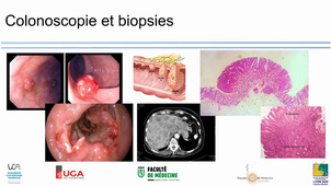 Prélèvements diagnostiques / anapath / immunohistochimie/ biologie moléculaire