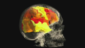Image par IRMf d'un cerveau humain.