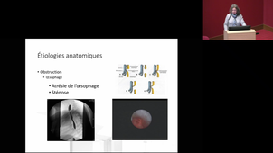troubles déglutition enfant et pathologies organiques