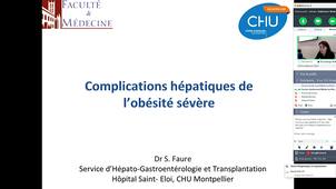 D.U PEC Obésité - Dr. Faure - Complcations hépatiques de l'obésité sévère