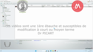 2024_MAND_K32_étape1.mp4