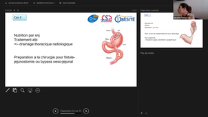 DU Obésité 17 Juin