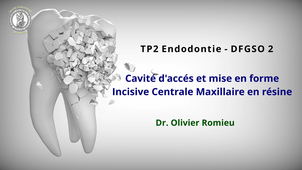 TP2 - Cavité Accès ICM en résine